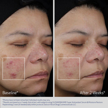 Super Antioxidant Serum